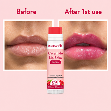 WishCare Ceramide Lip Balm Tinted with SPF 50 PA+++ (5g) before and after