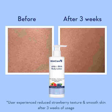 Wishcare AHA BHA Body Lotion with Niacinamide, Grapefruit & Blueberry (200ml) before after
