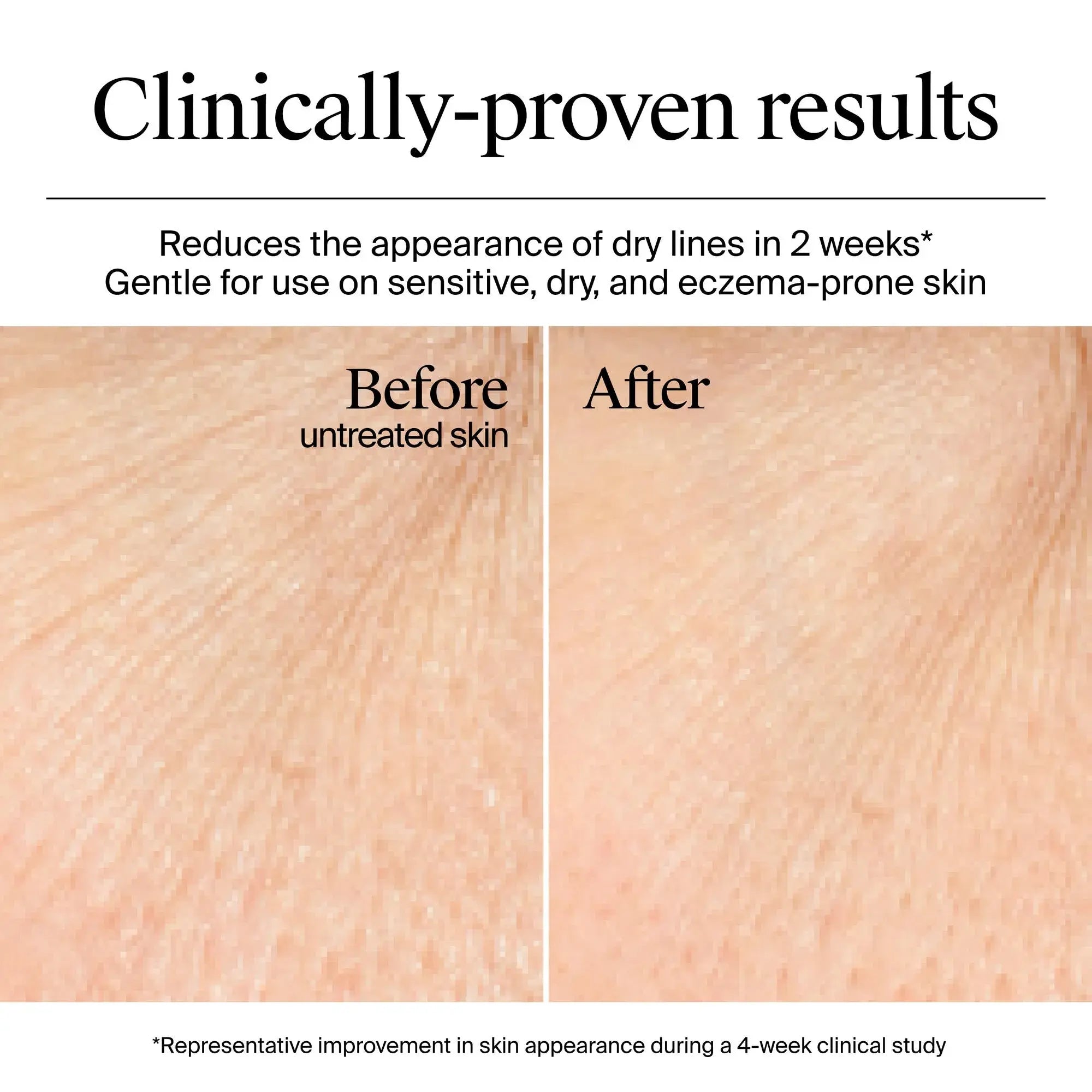 Neutrogena Hydro Boost Gel Cream For Dry Skin 50ml