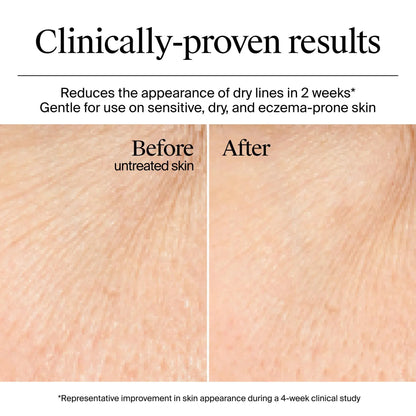 Neutrogena Hydro Boost Gel Cream For Dry Skin 50ml