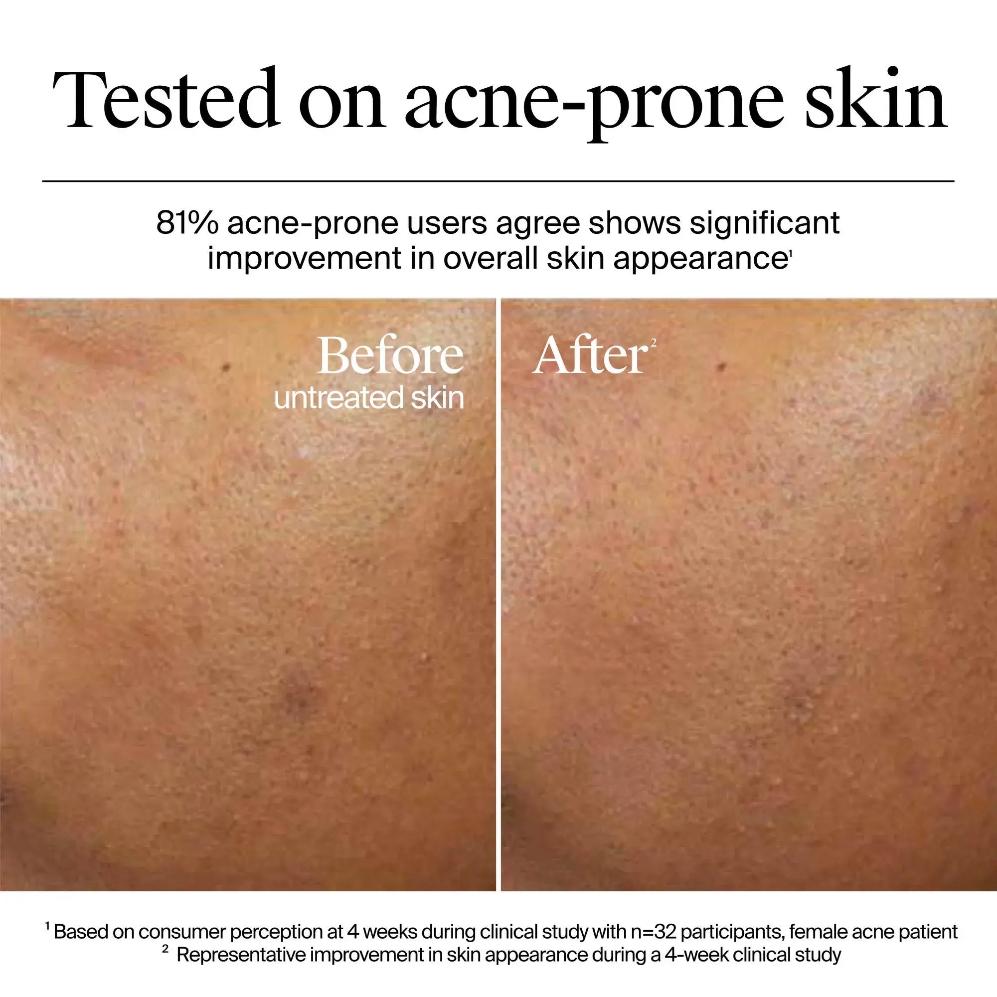 Neutrogena Hydro Boost Gel Cream For Dry Skin 50ml