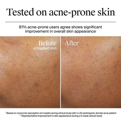 Neutrogena Hydro Boost Gel Cream For Dry Skin 50ml