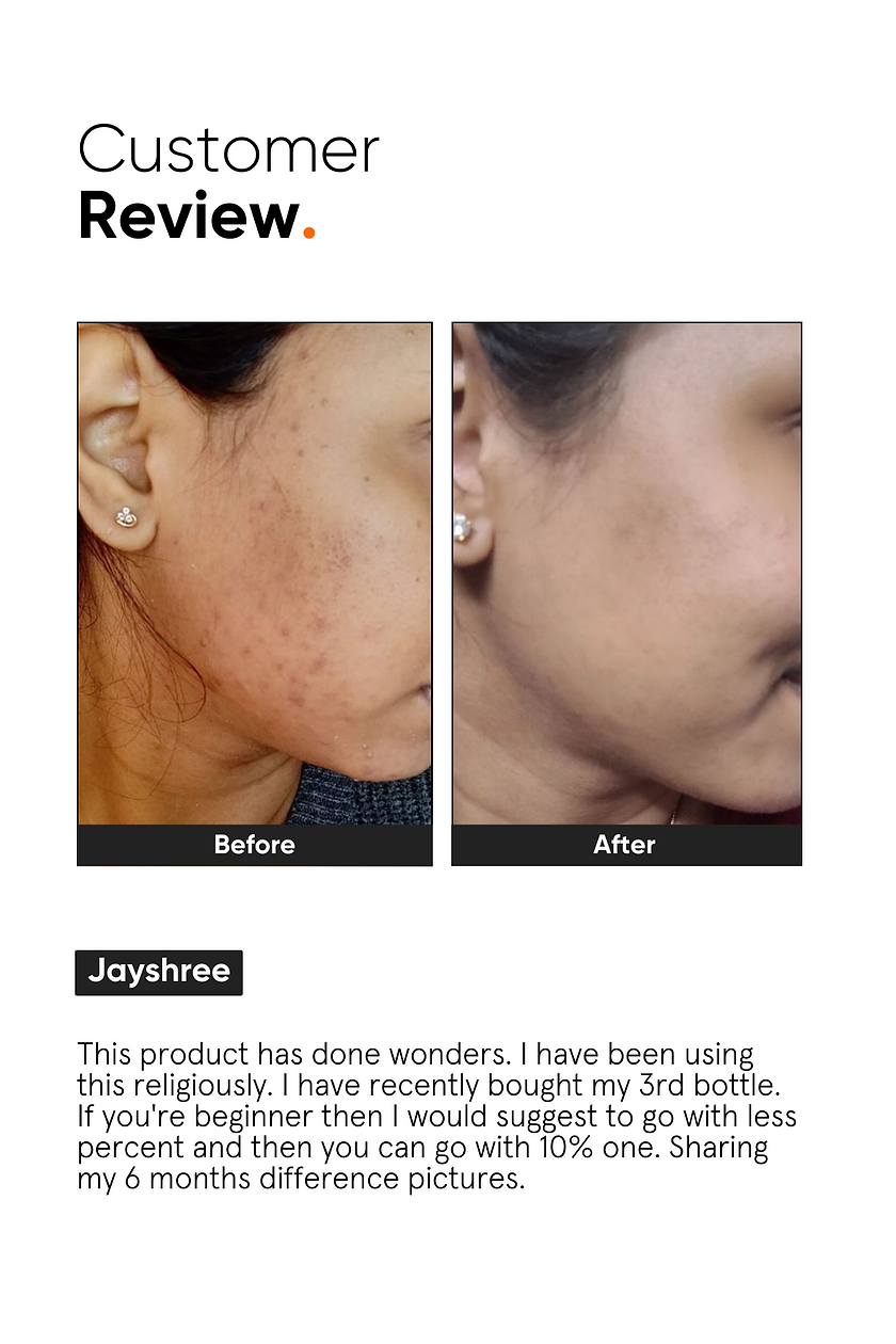 Minimalist Niacinamide 10% face serum (30ml) review