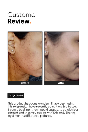 Minimalist Niacinamide 10% face serum (30ml) review from customer