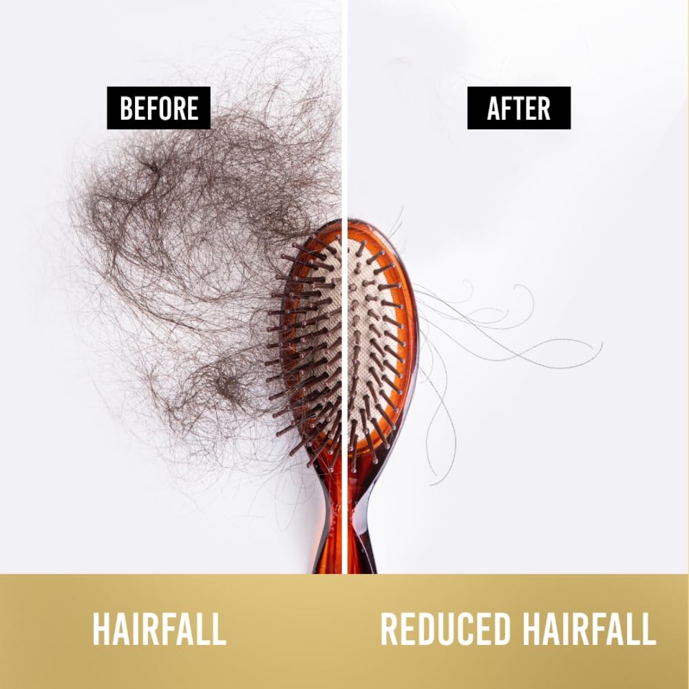 Pantene Advanced Hairfall Solution Anti-Hairfall Shampoo for Women (340ml)