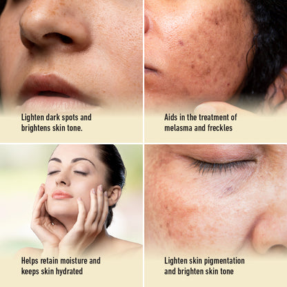 Skin Cafe My Therapist Serum - Brightening (30ml)