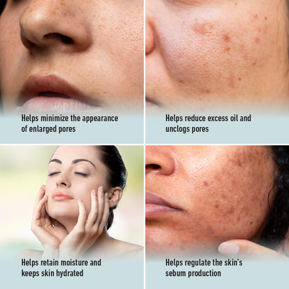 Skin Cafe My Therapist Serum - Pore Perfect (30ml)