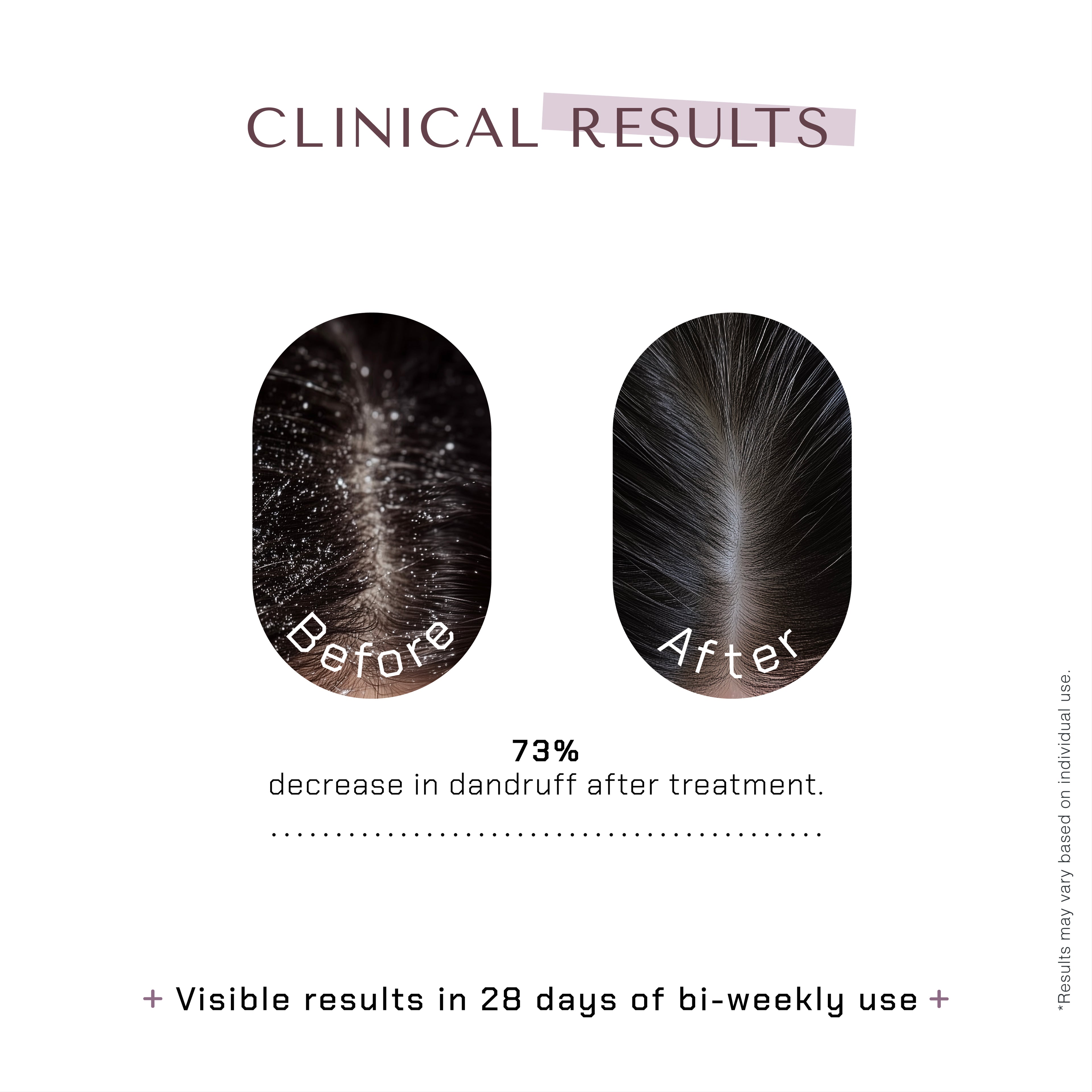 The Remedist by Dr Rhazes Ketonasel + Anti Dandruff Shampoo (100ml) results