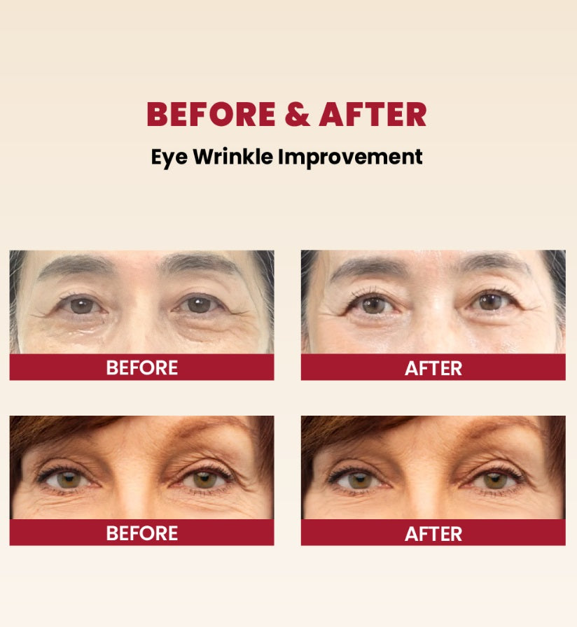 K-SECRET SEOUL 1988 Eye Cream : Retinal Liposome 4% + Fermented Bean 30ml