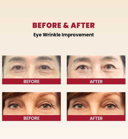 K-SECRET SEOUL 1988 Eye Cream : Retinal Liposome 4% + Fermented Bean 30ml