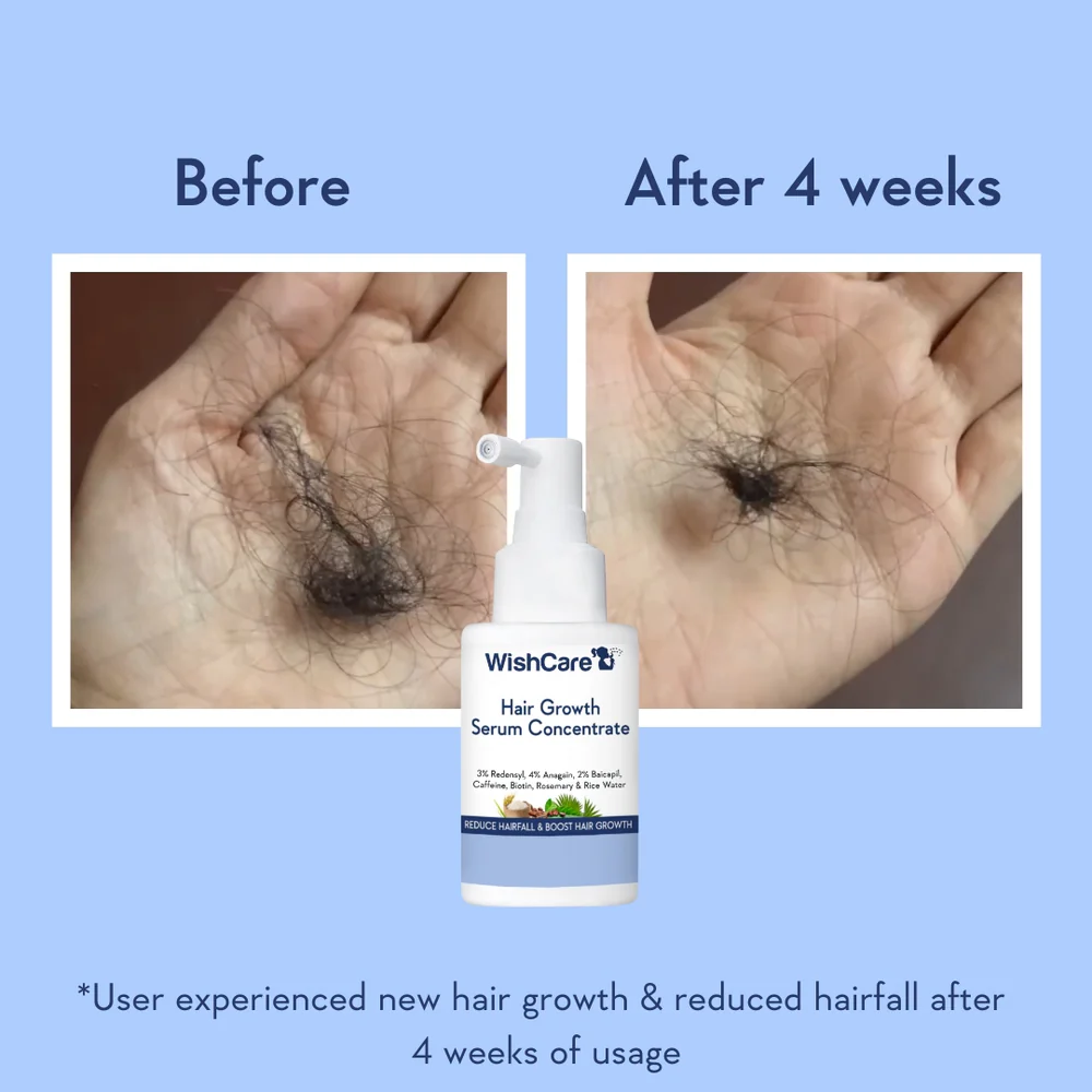 WishCare Hair Growth Concentrate Serum (30ml)