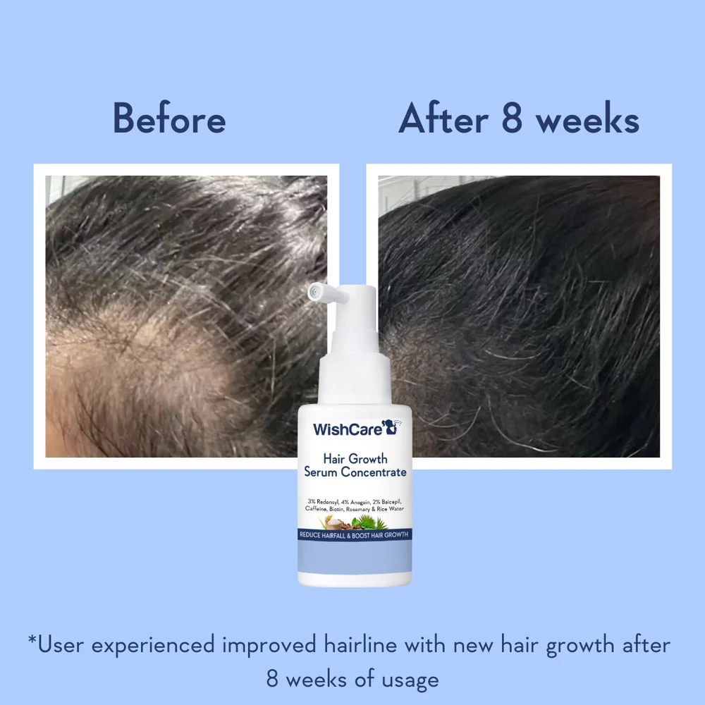WishCare Hair Growth Concentrate Serum (30ml)