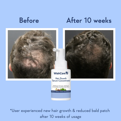 WishCare Hair Growth Concentrate Serum (30ml)