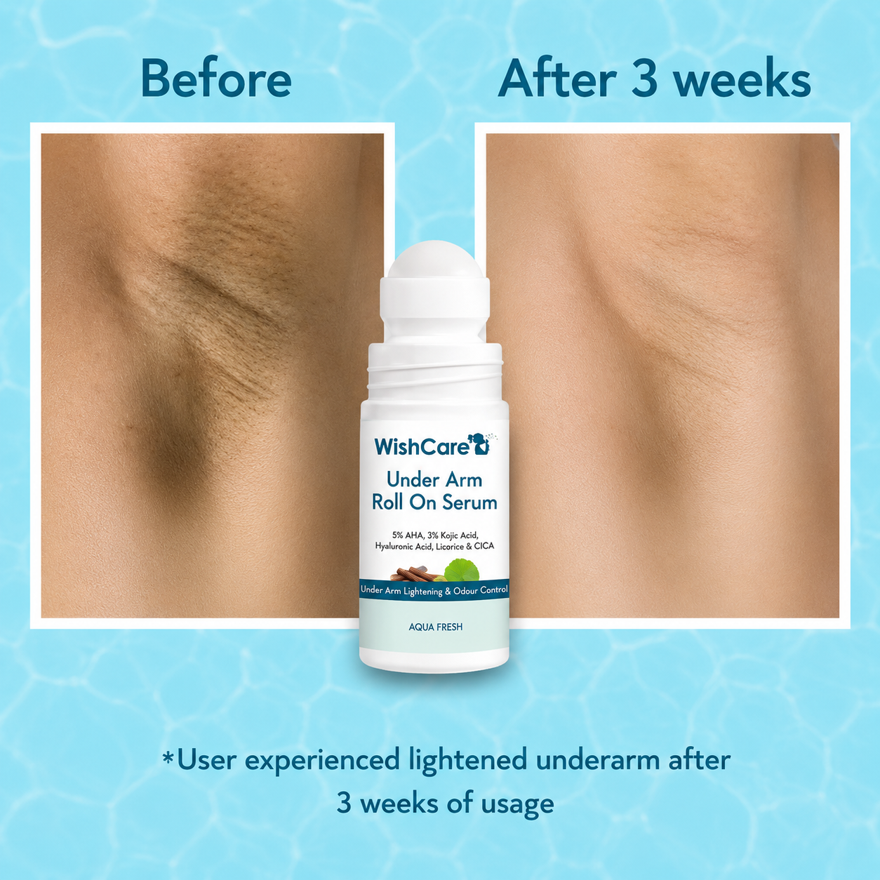 WishCare Under Arm Roll On Serum with Aqua Fresh (50ml)