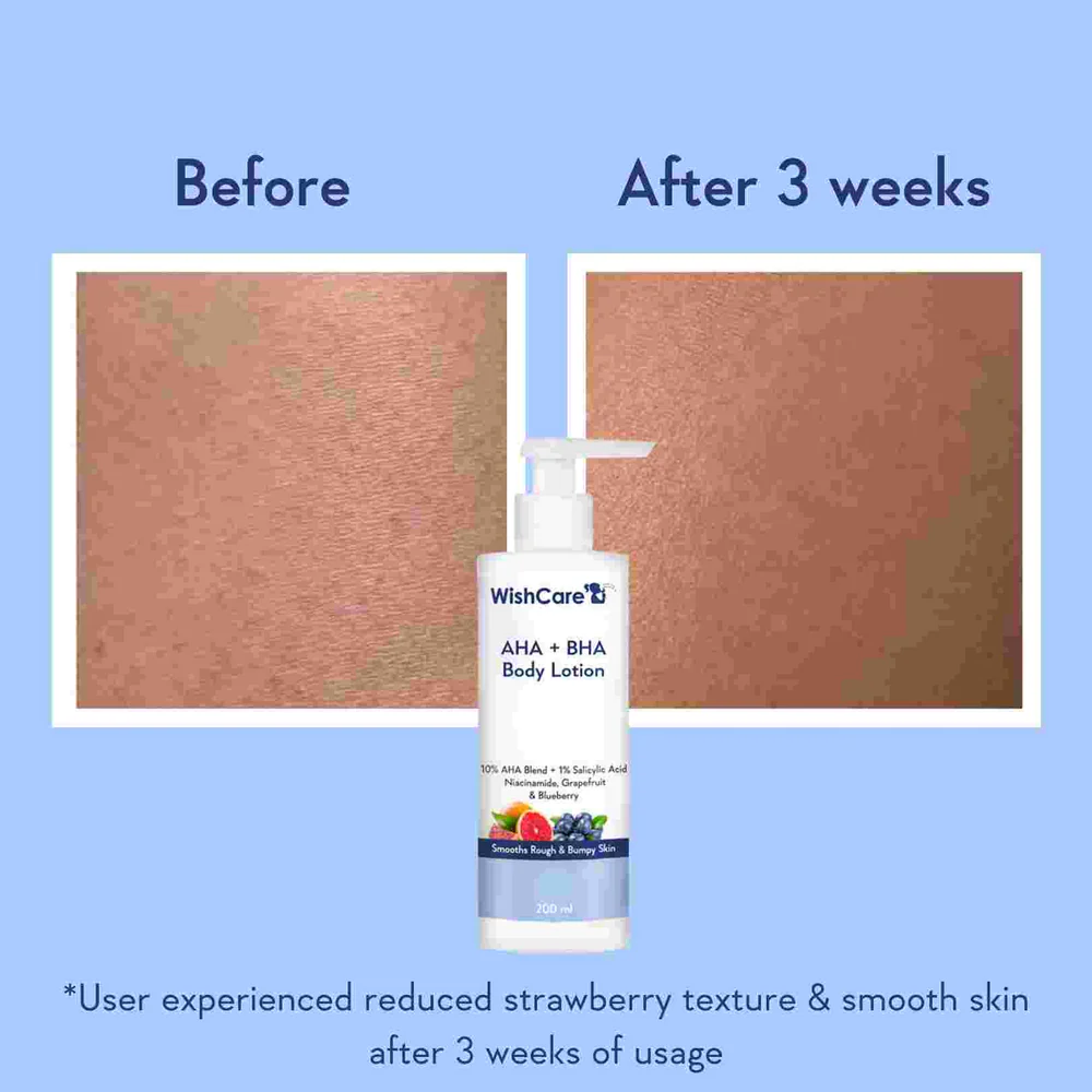 Wishcare AHA BHA Body Lotion with Niacinamide, Grapefruit &amp; Blueberry (200ml) before after