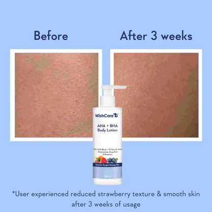 Wishcare AHA BHA Body Lotion with Niacinamide, Grapefruit &amp; Blueberry (200ml) before after