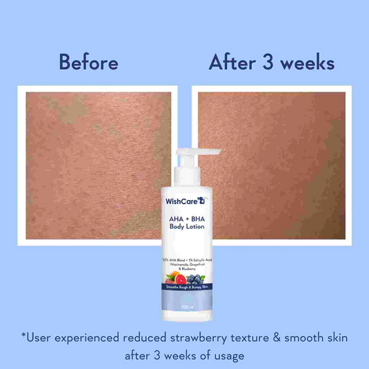 Wishcare AHA BHA Body Lotion with Niacinamide, Grapefruit &amp; Blueberry (200ml) before after