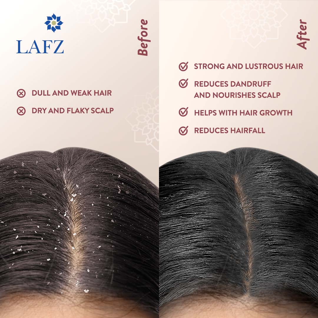 Lafz Essential Onion And Black Seed Hair Oil 100ml (Pack of 2) with Derma Roller