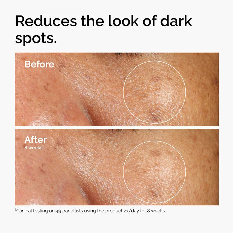 The Ordinary Alpha Arbutin 2% + HA Serum (30ml)