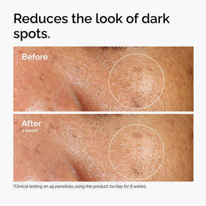 The Ordinary Alpha Arbutin 2% + HA Serum (30ml)