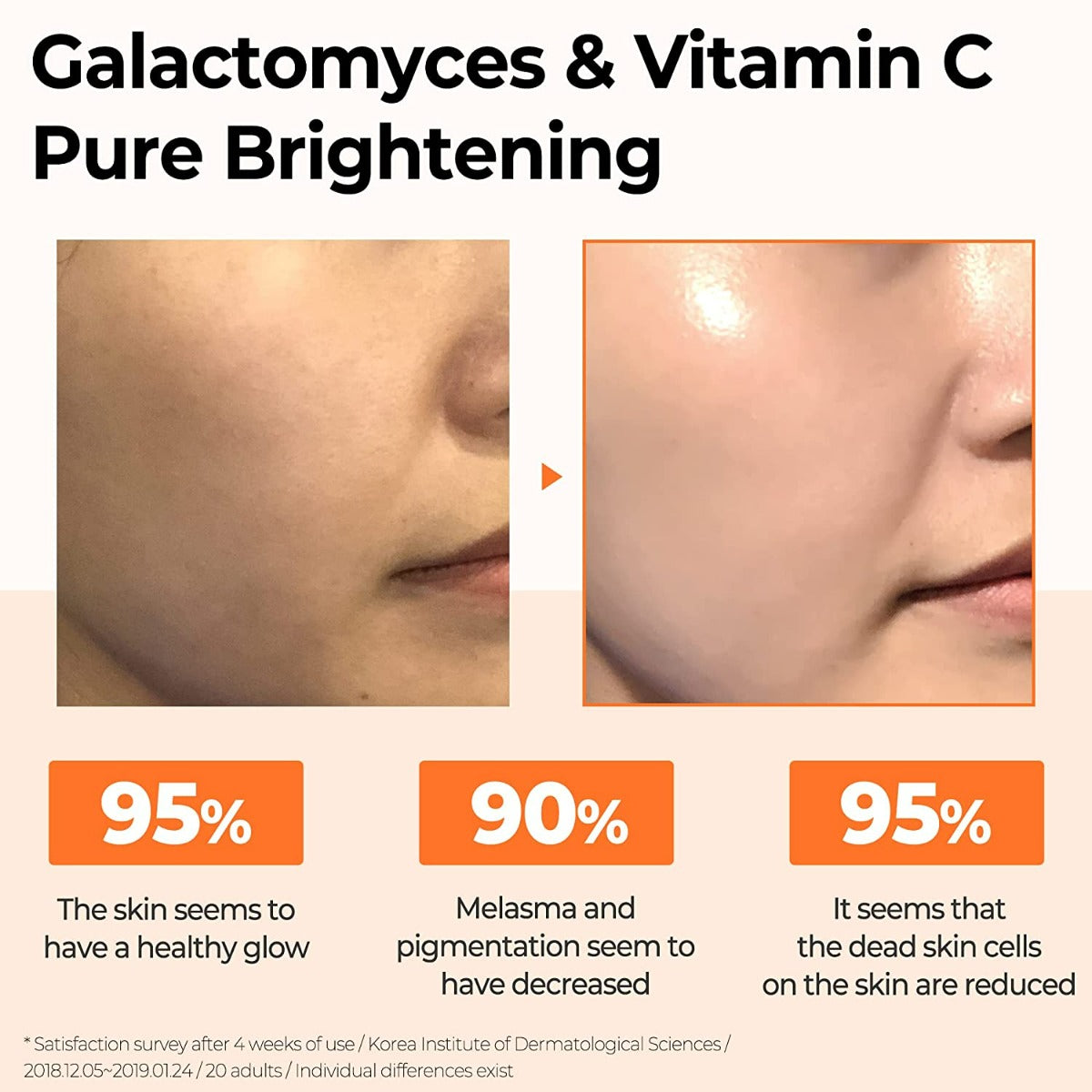 SOME BY MI Galactomyces Pure Vitamin C Glow Serum (30ml)